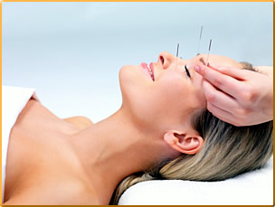 Akupunktur1